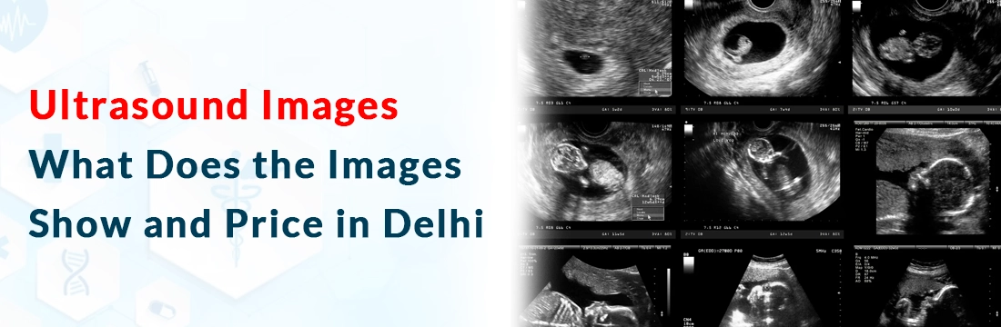 Ultrasound Images: What Does the Images Show and Price in Delhi